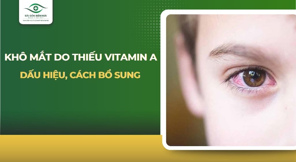 khô mắt do thiếu vitamin a
