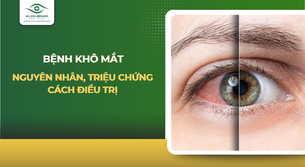 Khô mắt
