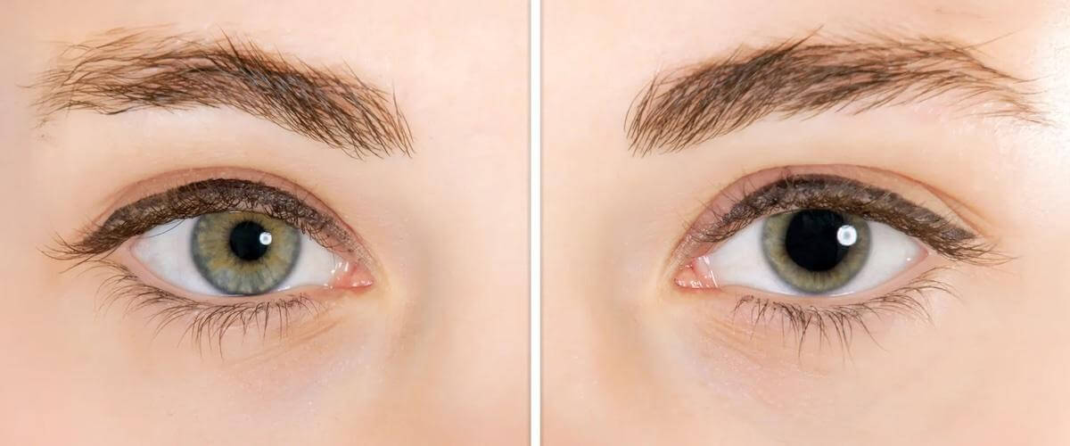 Kích thước đồng tử thay đổi linh hoạt theo nhiều yếu tố