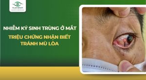 ký sinh trùng ở mắt