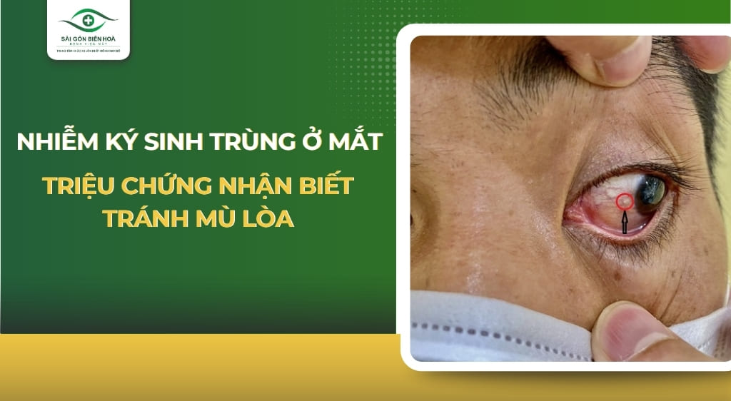 ký sinh trùng ở mắt