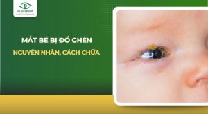 mắt bé bị đổ ghèn