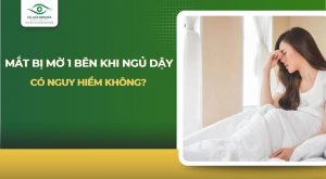 Mắt bị mờ 1 bên khi ngủ dậy