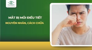 Mắt bị mỏi điều tiết