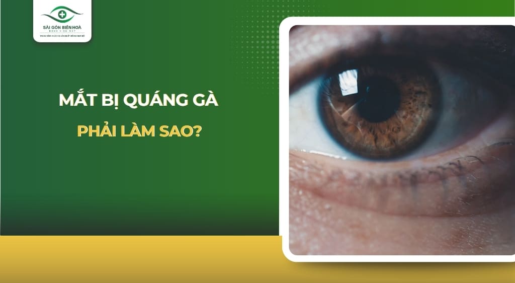 Mắt bị quáng gà phải làm sao