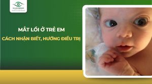 mắt lồi ở trẻ em
