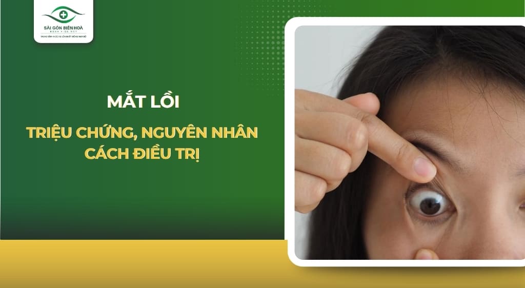 mắt lồi
