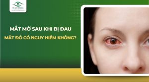 Mắt mờ sau khi bị đau mắt đỏ