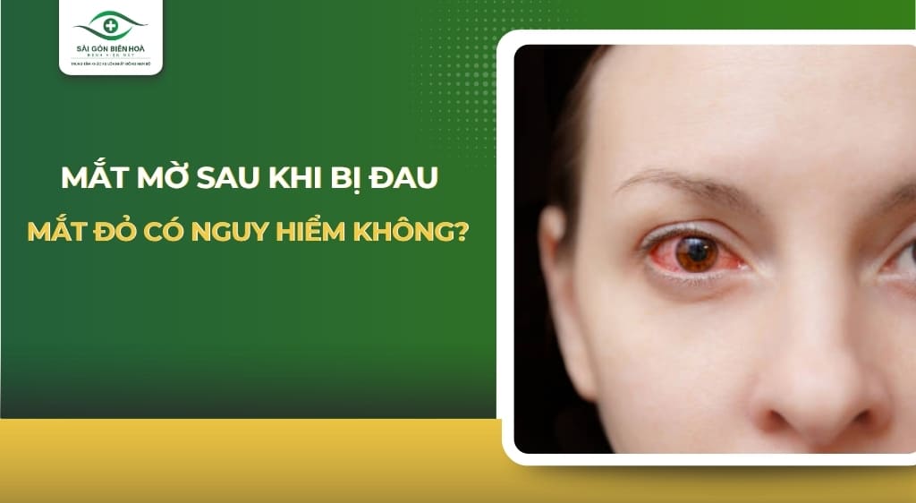 Mắt mờ sau khi bị đau mắt đỏ