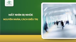 Mắt nhìn bị nhòe