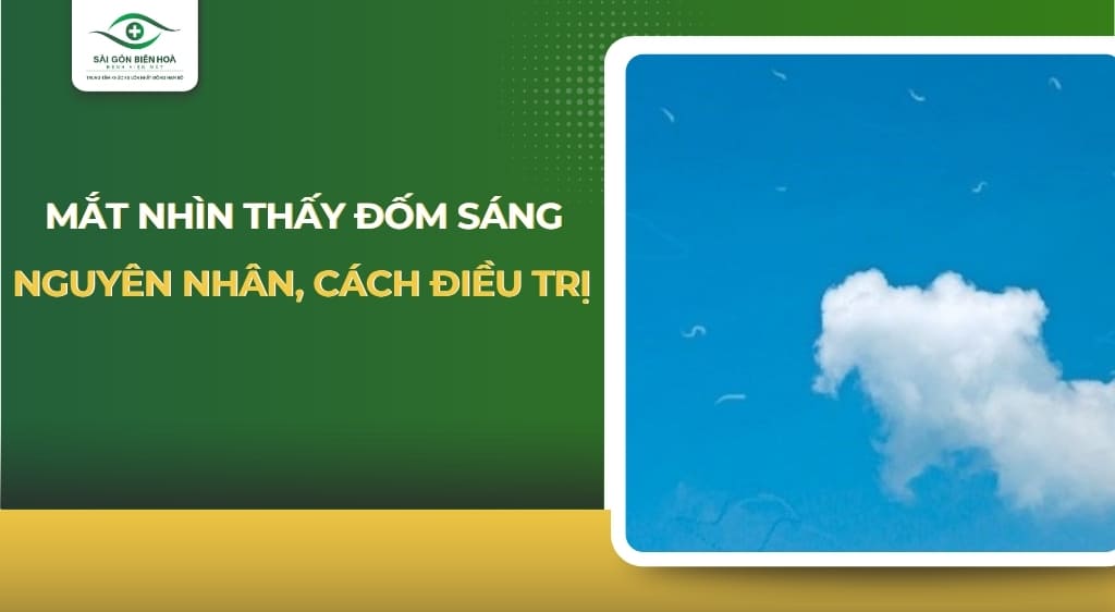 mắt nhìn thấy đốm sáng