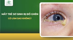 Mắt trẻ sơ sinh bị đổ ghèn