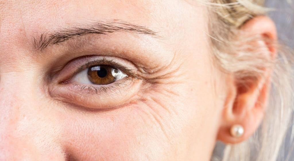 Mát xa mắt khi mỏi giúp giảm quầng thâm và ngăn ngừa nếp nhăn hiệu quả