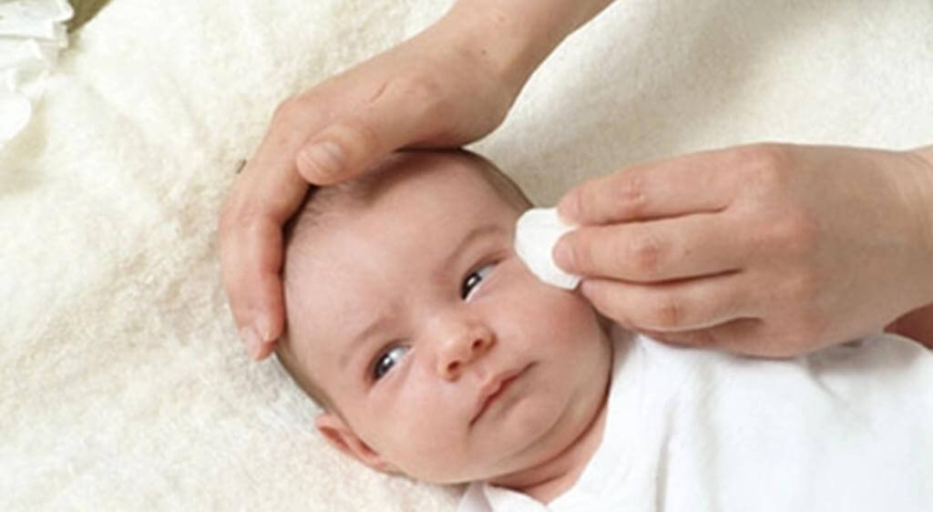 Nên dùng bông gòn thấm dung dịch vệ sinh mắt chuyên dụng để lau mắt cho bé hằng ngày