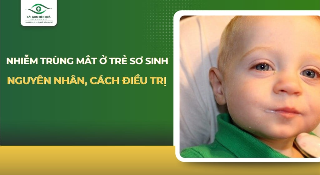 Nhiễm trùng mắt ở trẻ sơ sinh