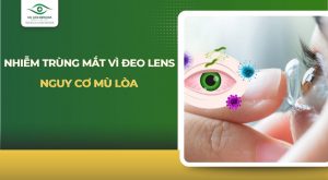 Nhiễm trùng mắt vì đeo lens