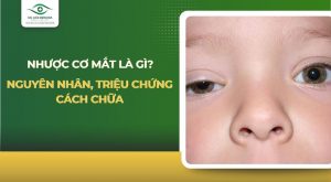 Nhược cơ mắt