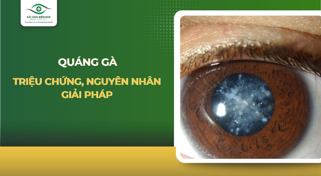quáng gà