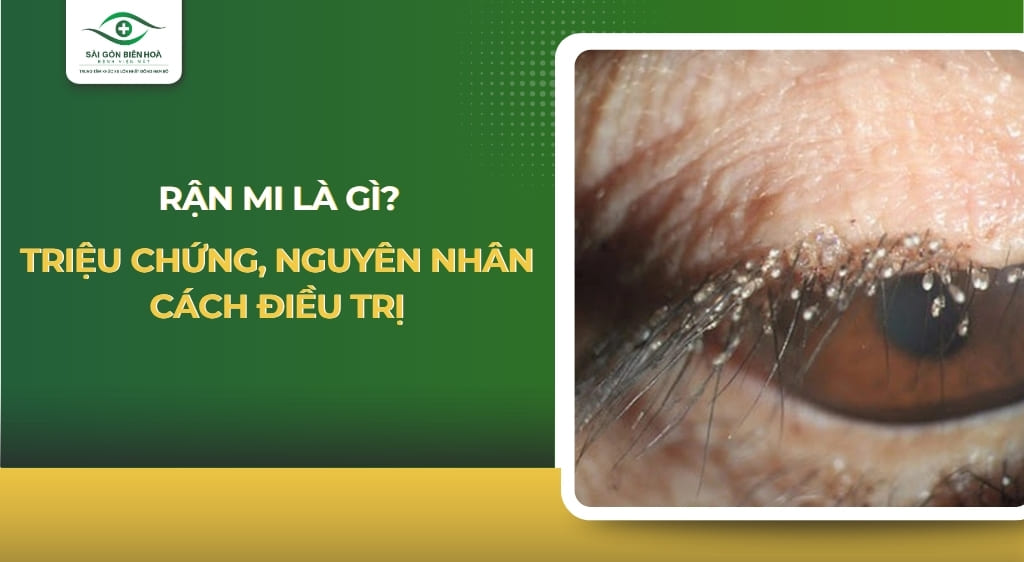 rận mi