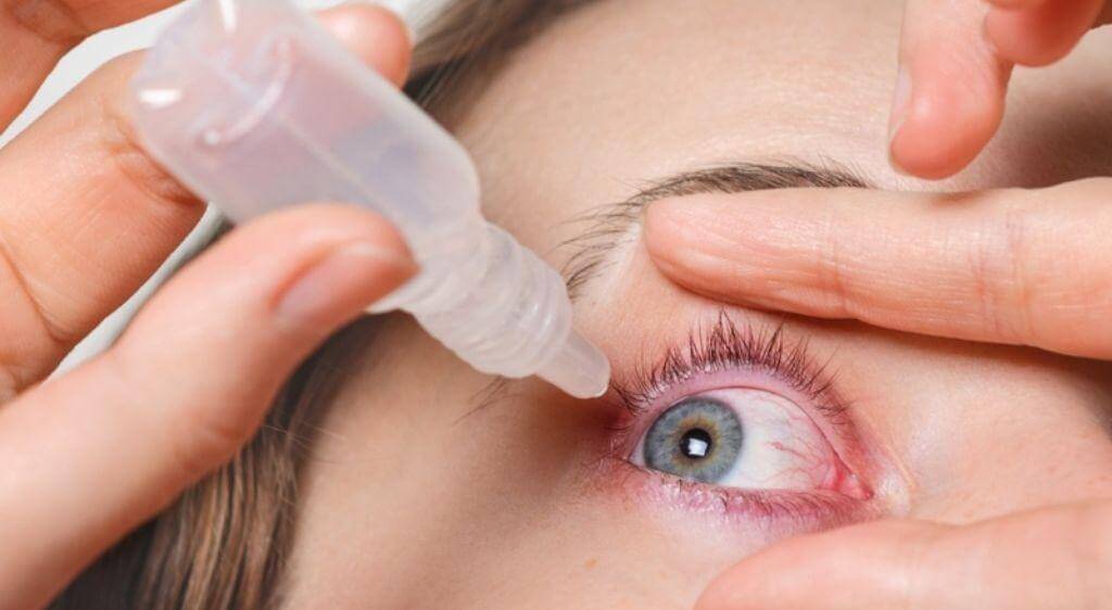 Sử dụng thuốc nhỏ mắt theo chỉ định của bác sĩ