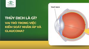 Thủy dịch là gì? Vai trò trong việc kiểm soát nhãn áp và Glaucoma?