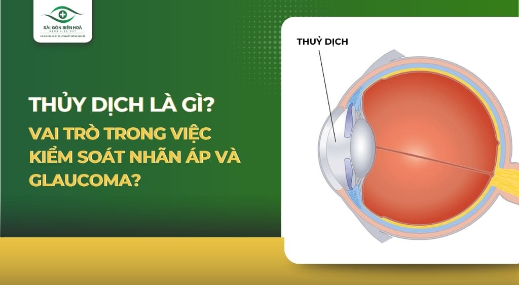 Thủy dịch là gì? Vai trò trong việc kiểm soát nhãn áp và Glaucoma?