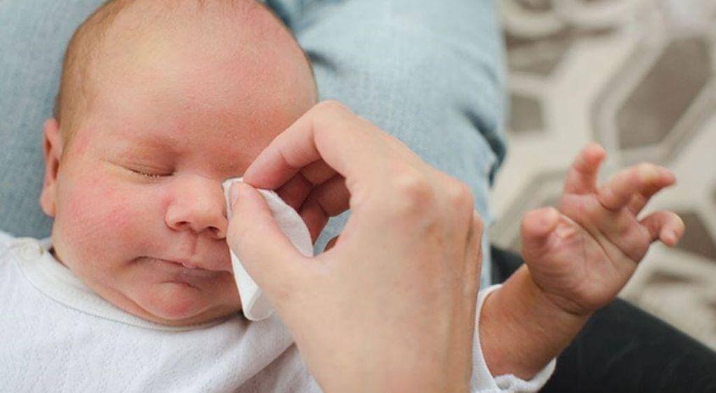Vệ sinh mắt cho bé bằng nước muối sinh lý
