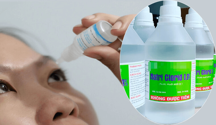 Vệ sinh vùng mắt bị đốt bằng nước muối sinh lý và chườm lạnh là cách giảm sưng an toàn