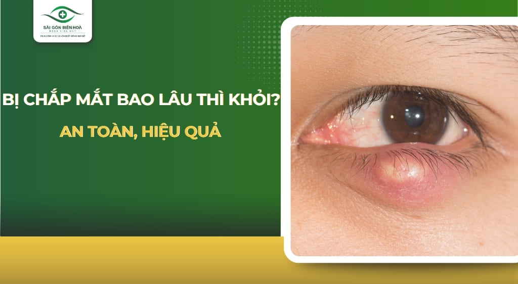 bị chắp mắt bao lâu thì khỏi
