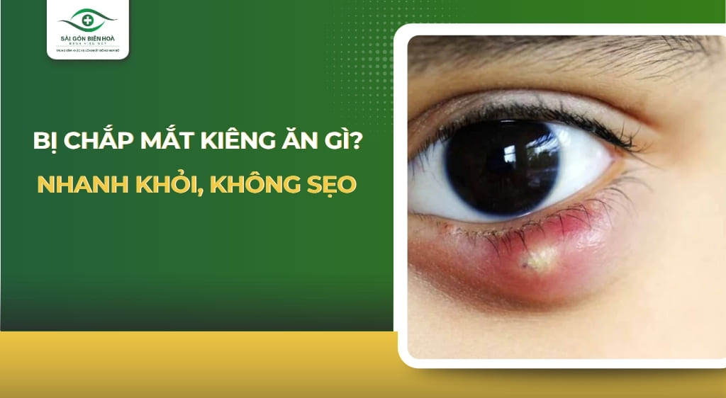 Bị chắp mắt kiêng ăn gì