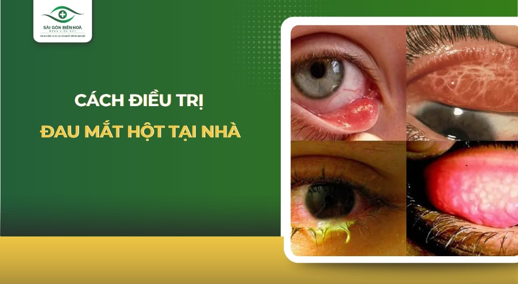 Cách điều trị đau mắt hột tại nhà