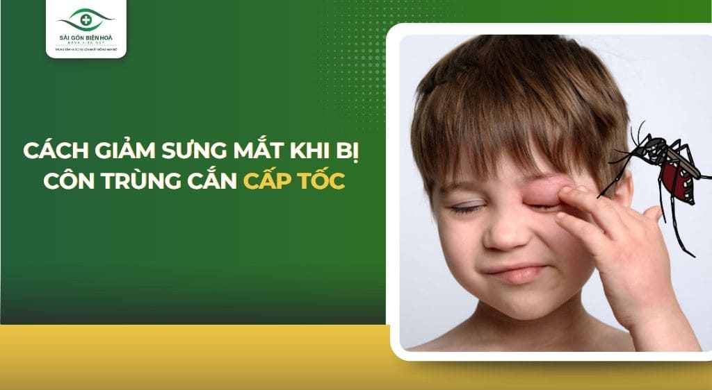 cách giảm sưng mắt khi bị côn trùng cắn