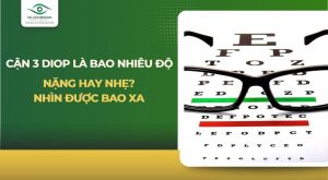 Cận 3 diop là bao nhiêu độ