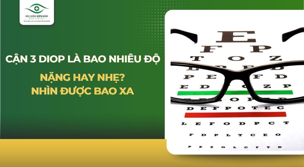 Cận 3 diop là bao nhiêu độ