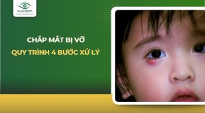 Chắp mắt bị vỡ