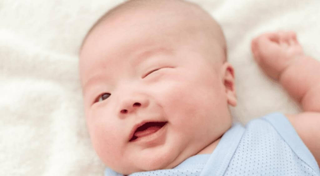 Chắp mắt ở trẻ dưới 2 tuổi thường gây sưng cục bộ mí mắt, sờ thấy cục nhỏ