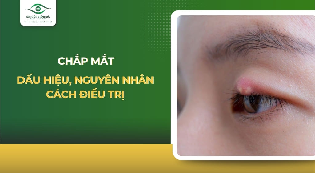 chắp mắt