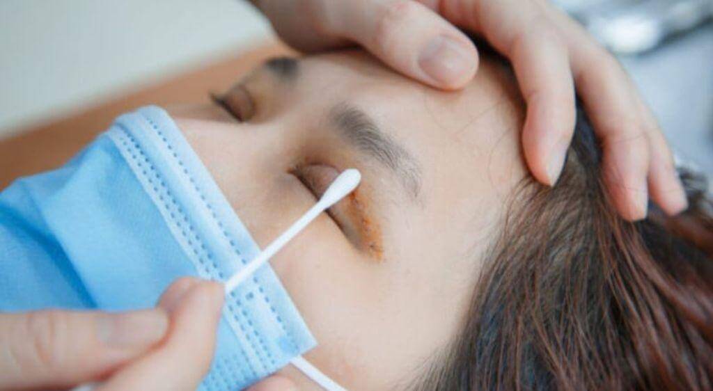 Chế độ chăm sóc và bảo vệ mắt tại nhà có vai trò không nhỏ vào chế độ phục hồi của mí mắt