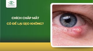 Chích chắp mắt có để lại sẹo không