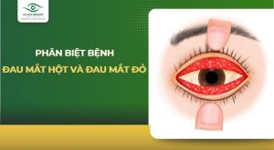 đau mắt hột và đau mắt đỏ