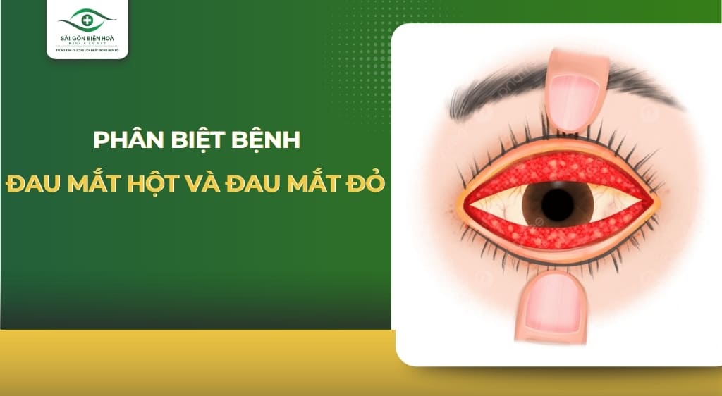 đau mắt hột và đau mắt đỏ