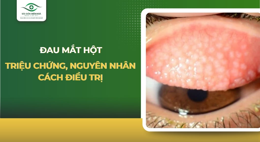 Đau mắt hột