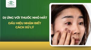 Dị ứng với thuốc nhỏ mắt