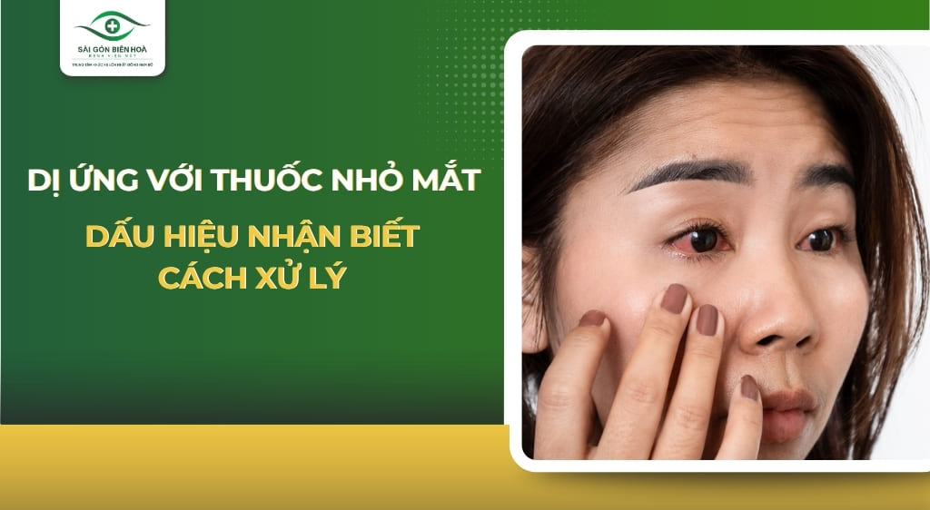 Dị ứng với thuốc nhỏ mắt