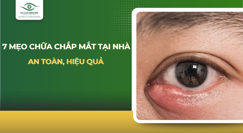 mẹo chữa chắp mắt