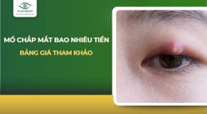 mổ chắp mắt bao nhiêu tiền