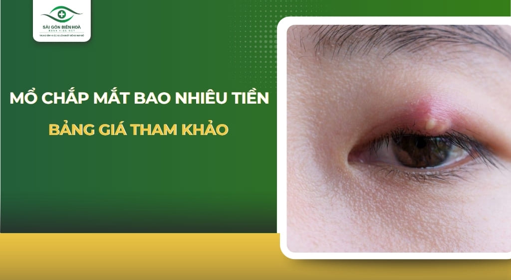 mổ chắp mắt bao nhiêu tiền