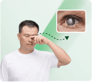 Phẫu thuật cườm nước