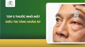 thuốc nhỏ mắt điều trị tăng nhãn áp
