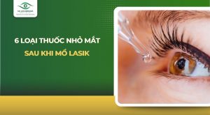 thuốc nhỏ mắt sau khi mổ
